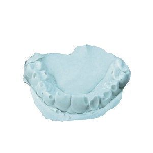 치아모형 만들기(10인용)