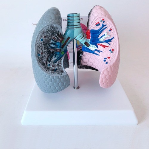 인체 흡연 폐 비교모형