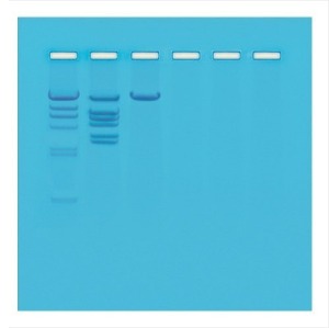 DNA의 제한효소 분석