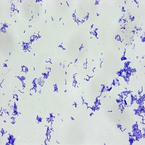 연쇄상구균(Streptococcus)(Carolina)
