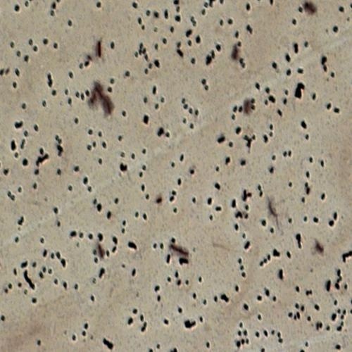 박테리아 편모충(Bacterial Flagella)(Carolina)