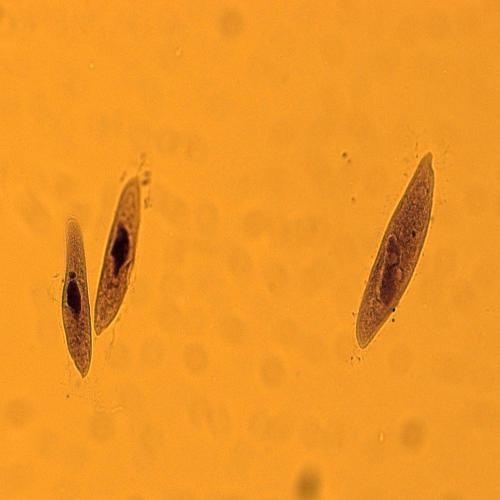 짚신벌레(Paramecium) 슬라이드